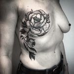Mastectomy tattoo for Cheryl by Phil Mann #PhilMann #mastectomytattoo #mastectomyscarcoveruptattoo #scarcoveruptattoo #nippletattoo #mastectomy
