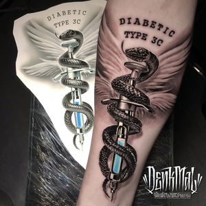 Diabetes tattoo by Denk Mal Tattoo #DenkMal #diabetictattoo #diabetictattoos #diabetic #medicaltattoo