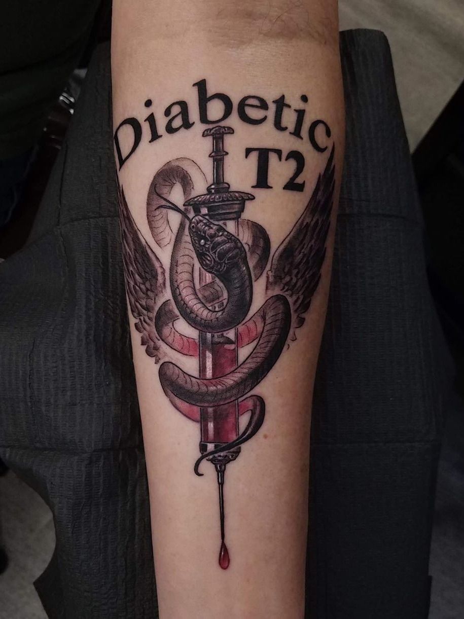 Tattoo uploaded by Andrew Scott • Diabetic tattoo by Zack Miller  #ZackMiller #diabetictattoo #diabetictattoos #diabetic #medicaltattoo •  Tattoodo