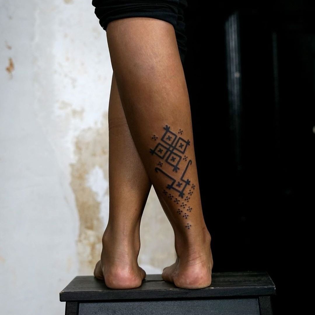 Tattoo Removal for Darker Skin London  Pulse Light Clinic London