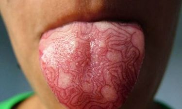 Let's Talk About Tongue Tattoos