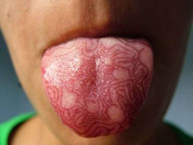 Let's Talk About Tongue Tattoos