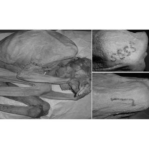 Infrared images of the Gebelein woman and her tattoos (Credit: Copyright Trustees of the British Museum) #ancientegypt #historyoftattoos #figuraltattoos #Egypt #ancienttattoos #tattooculture #tattoohistory #egyptiantattoos