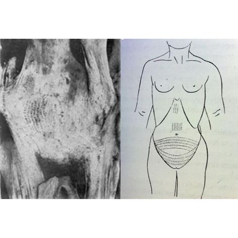 A scan and sketch of Amunet’s beaded tattoo design #ancientegypt #amunetmummy #fertilitytattoos #geometrictattoos #Egypt #ancienttattoos #tattooculture #tattoohistory #egyptiantattoos