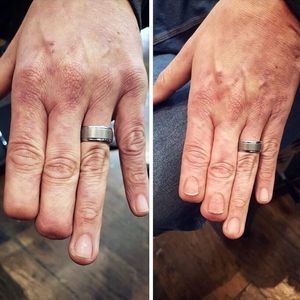 Realistic fingernail restoration tattoo by Eric Catalano #EricCatalano #fingertattoo #fingernailtattoo #paramedicaltattooing #cosmetictattooing #restorativetattoos #anatomytattoo 