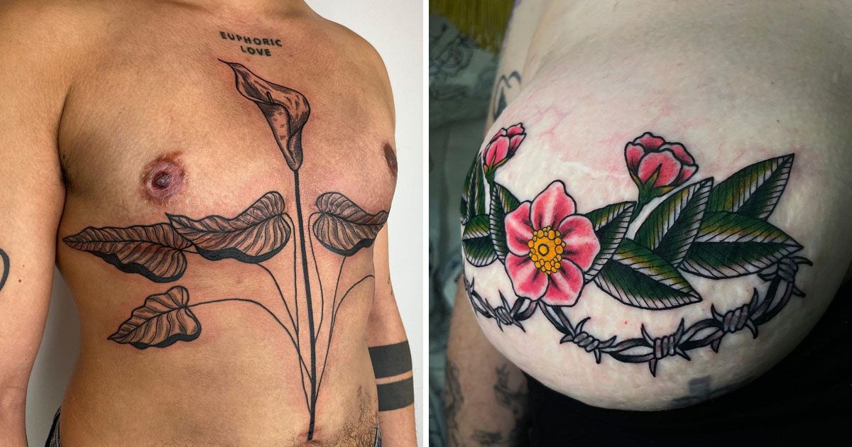 Transforming Scars and Birthmarks into Stunning Works of Art