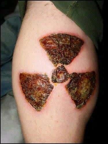 Scarification infection
