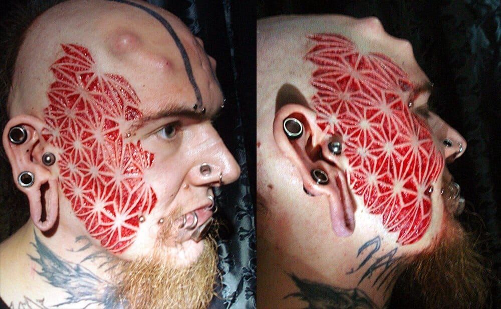 Face scarification