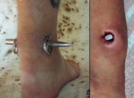 Extreme body piercing