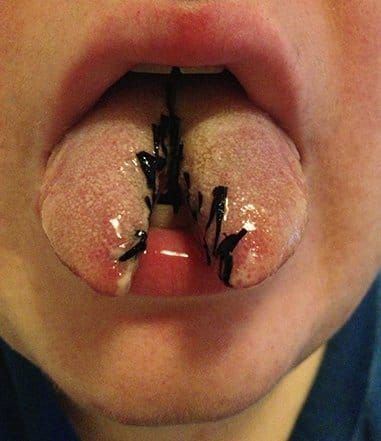 Might we say, tongue-tied?! :P