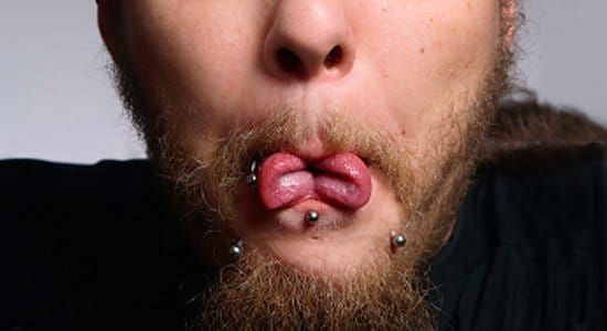 Tongue Splitting