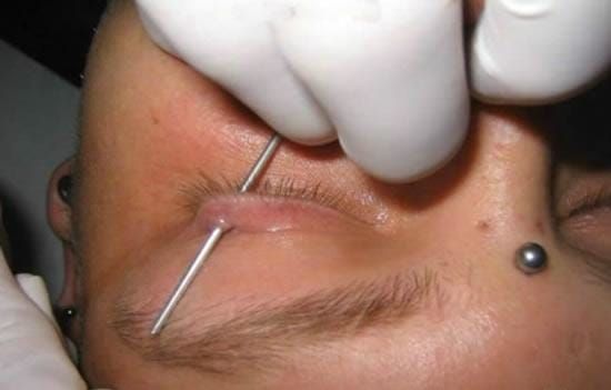 Getting an eyelid piercing
