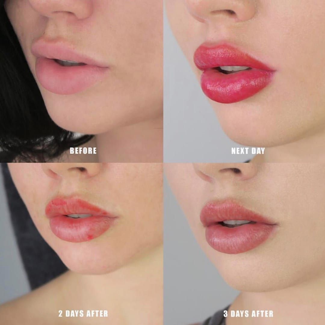 Lip Blush Tattoo Before and After  Pursuing Pretty