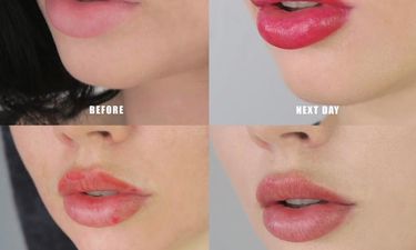 Lip Blush 101: Pucker Up That Pout