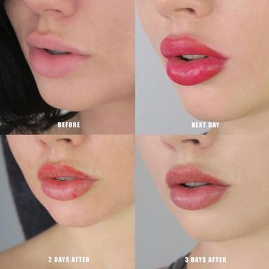 Lip Blush 101: Pucker Up That Pout