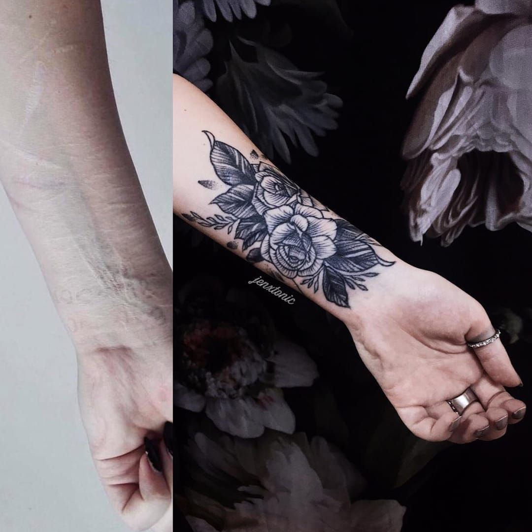 Not mine but fine A little scar cover up tattoo  rinterestingasfuck