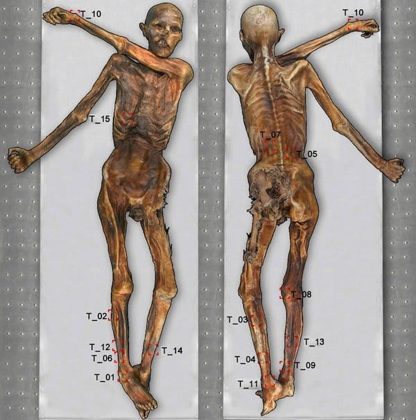 Otzi, the iceman