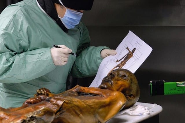 Otzi, the iceman