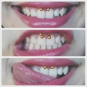 Piercing risk: Tooth Enamel Wear