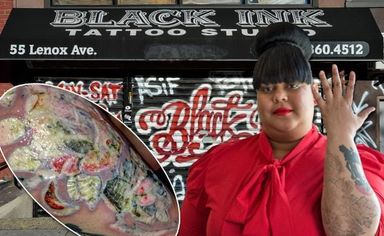 Tatuagem Infeccionada: Todo Cuidado é Pouco