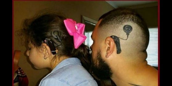 Irish dad gets a tattoo of sons cochlear implant Viral video will make  you emotional  India Today