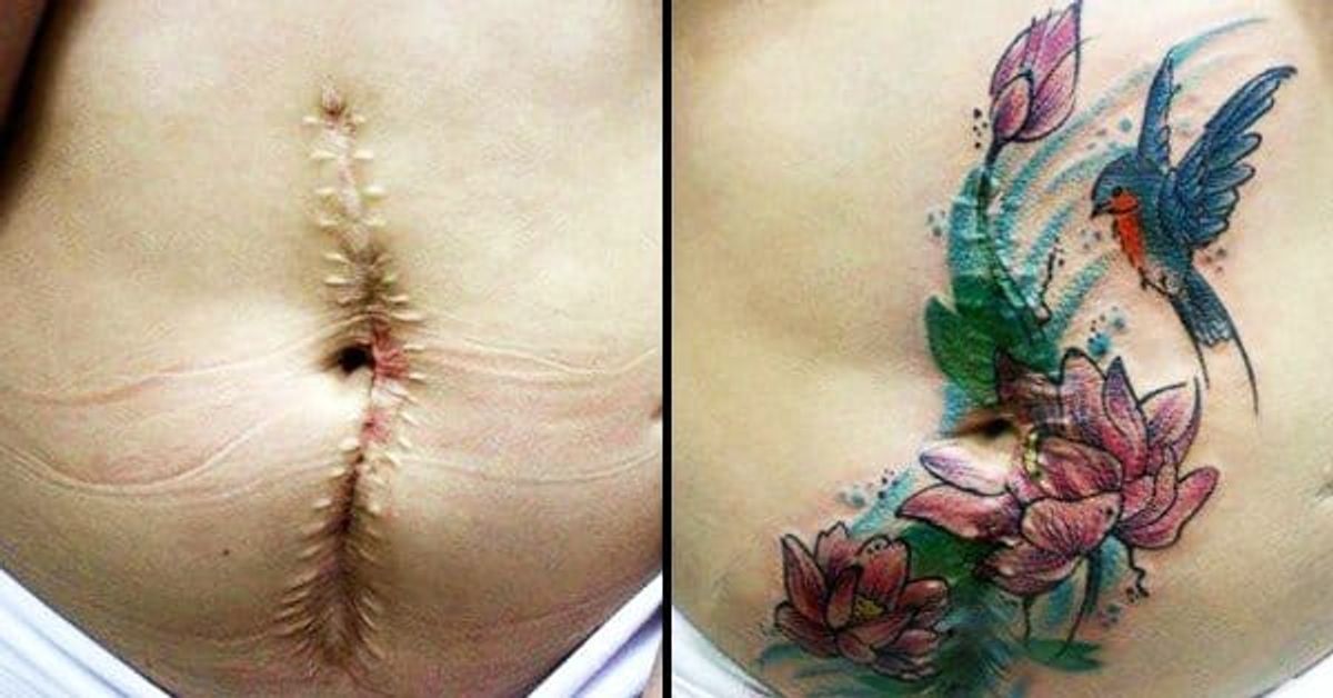 A Brazilian Tattoo Artist Is Turning Scars Into Something Beautiful • Tattoodo A Brazilian Tattoo Artist Is Turning Scars Into Something Beautiful • Tattoodo