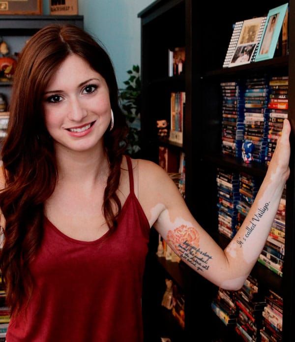 Woman Shares Photo Of Poignant Vitiligo Tattoo To Educate Those Who Stop  And Stare  HuffPost UK Life