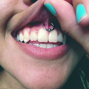 Smiley Piercing #Piercing #BodyModification #Oralpiercings #smiley