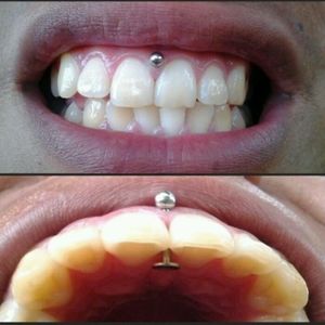 Gum Piercing #Piercing #BodyModification #Oralpiercings #gum