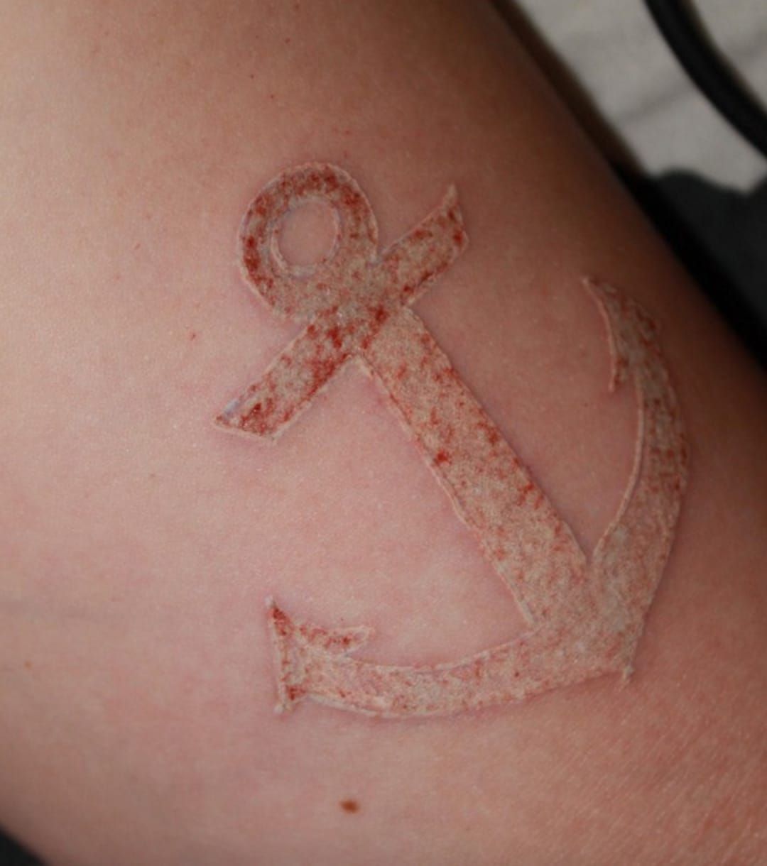 Is My New Tattoo Infected What Should I Do About It  TatRing