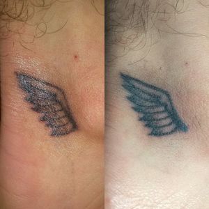Before and after#handpoke