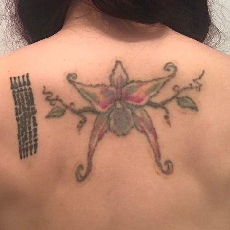 Una semana después del primer tratamiento con láser: el tatuaje que finalmente logré eliminar gracias a Clean Canvas More Art.  #CleanCanvasMoreArt #lasertattooremoval #tattooremoval