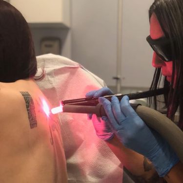 Getting lasered by Bethany of Clean Canvas More Art #CleanCanvasMoreArt #lasertattooremoval #tattooremoval
