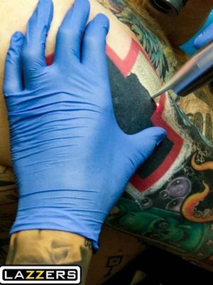 Tattoo laser removal and lightening @Stoneheartlaser