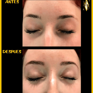 Eyebrow definition in microblading.