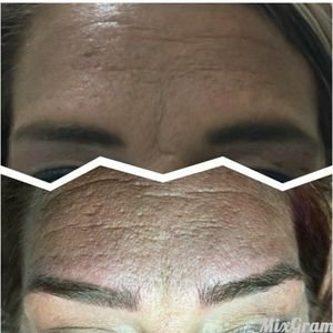 Before and after Microblading brows 