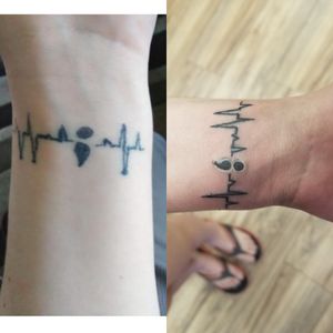 Before and after I fixed a wonky tattoo