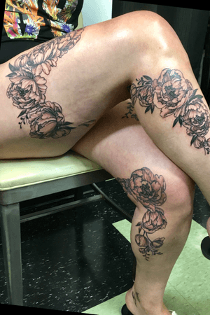 Black and grey Peonies to cover spider veins