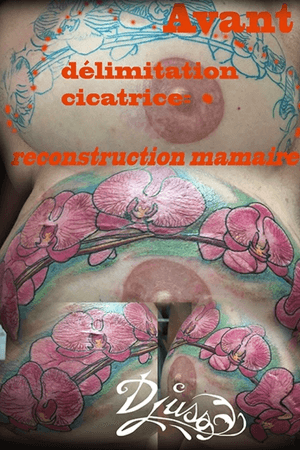 Cover up de cicatrive de cancer du sein. Revonstruction mammaire cachée avec tatouage d’orchidées sur une branche