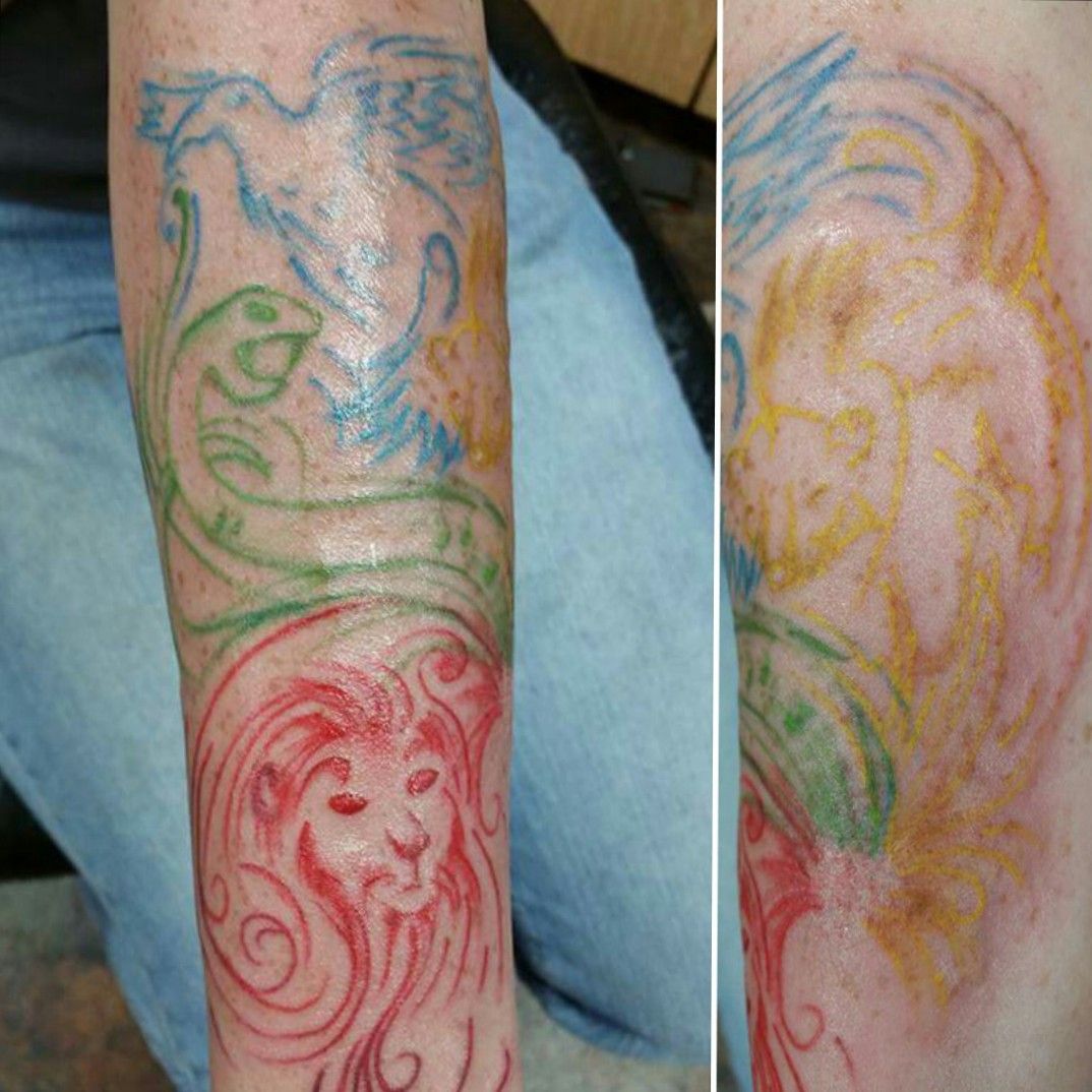 Tattoo Removal How To Prepare and What To Expect  Trillium Creek Blog