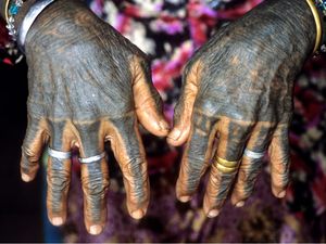 The Kayan hand tattoos of Ado Ngo promote fertility and repel evil spirits encountered in the jungle. Borneo. Photo: © Lars Krutak 2011. #LarsKrutak #tattoohistory #tattooculture #tattooanthropologist