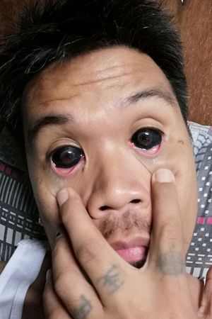 My eye ball tattoo