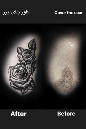 Cover up the scar!!! كاور جاي ليزر #coverup #coveruptattoo #Rosetattoo #Rose #blackandgrey #realistic #coverup 