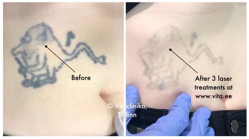 Tattoo image