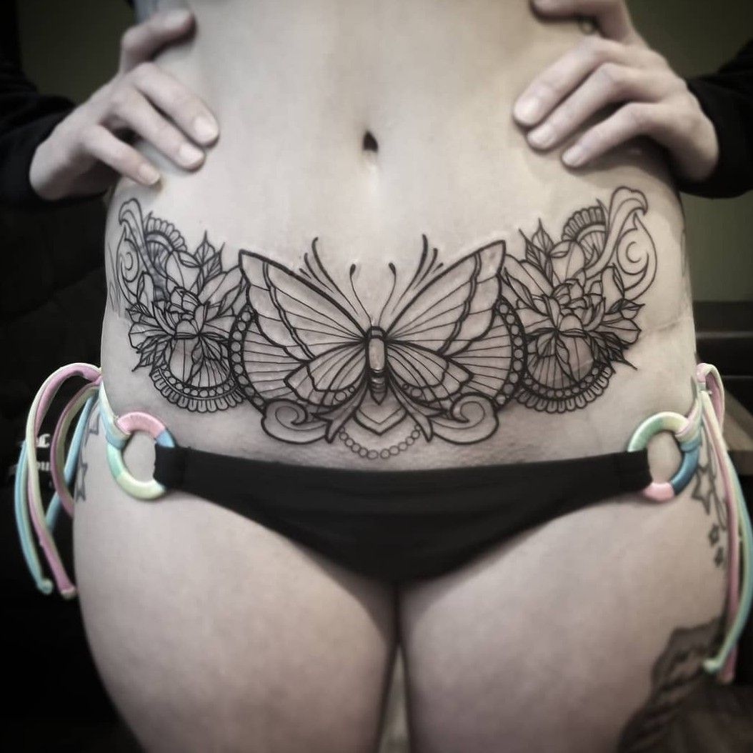 Tattoo uploaded by Russell McCabe • Tummy tuck scar coverup • Tattoodo