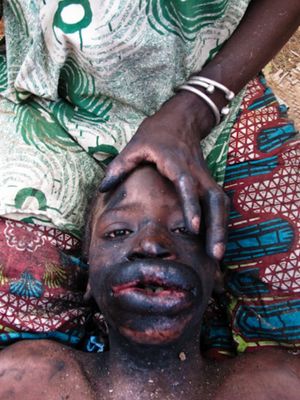 Mouth tattooing by the Fulani - photo by the Pulaku Project - #fulani #Tchoodi #ancientbodymodifications #bodymodifications #bodymods #tribal
