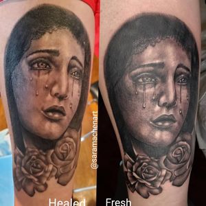 Fresh vs healed grayscale no photoshop no filters no touch ups 