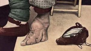 Foot binding #footbinding #ancientbodymodifications #bodymodifications #bodymods #tribal