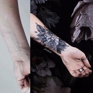 Self Harm Scar Cover Up Tattoo by Jen Tonic #JenTonic #selfharmscarcoveruptattoo #coveruptattoo #scarcoveruptattoo #scarcoverup #coverup #rose #illustrative #blackwork #linework #flowers #floral