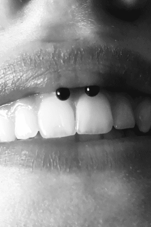 #smileypiercing